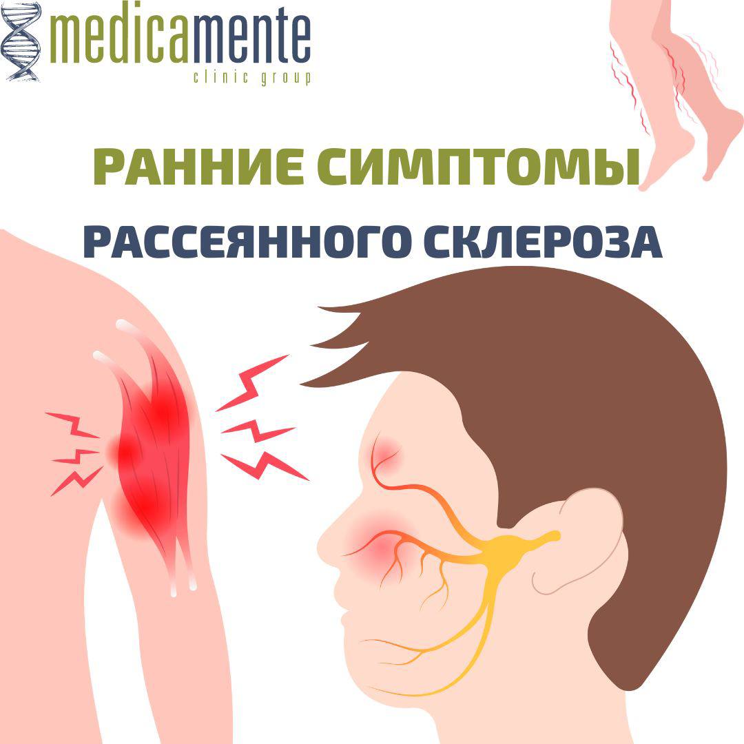 Ранние симптомы рассеянного склероза